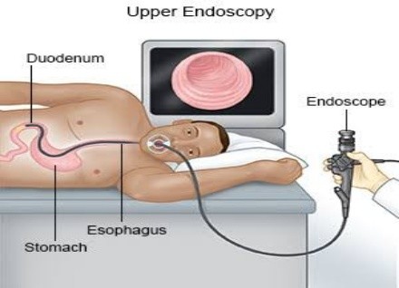 Endoscopy in Nigeria 